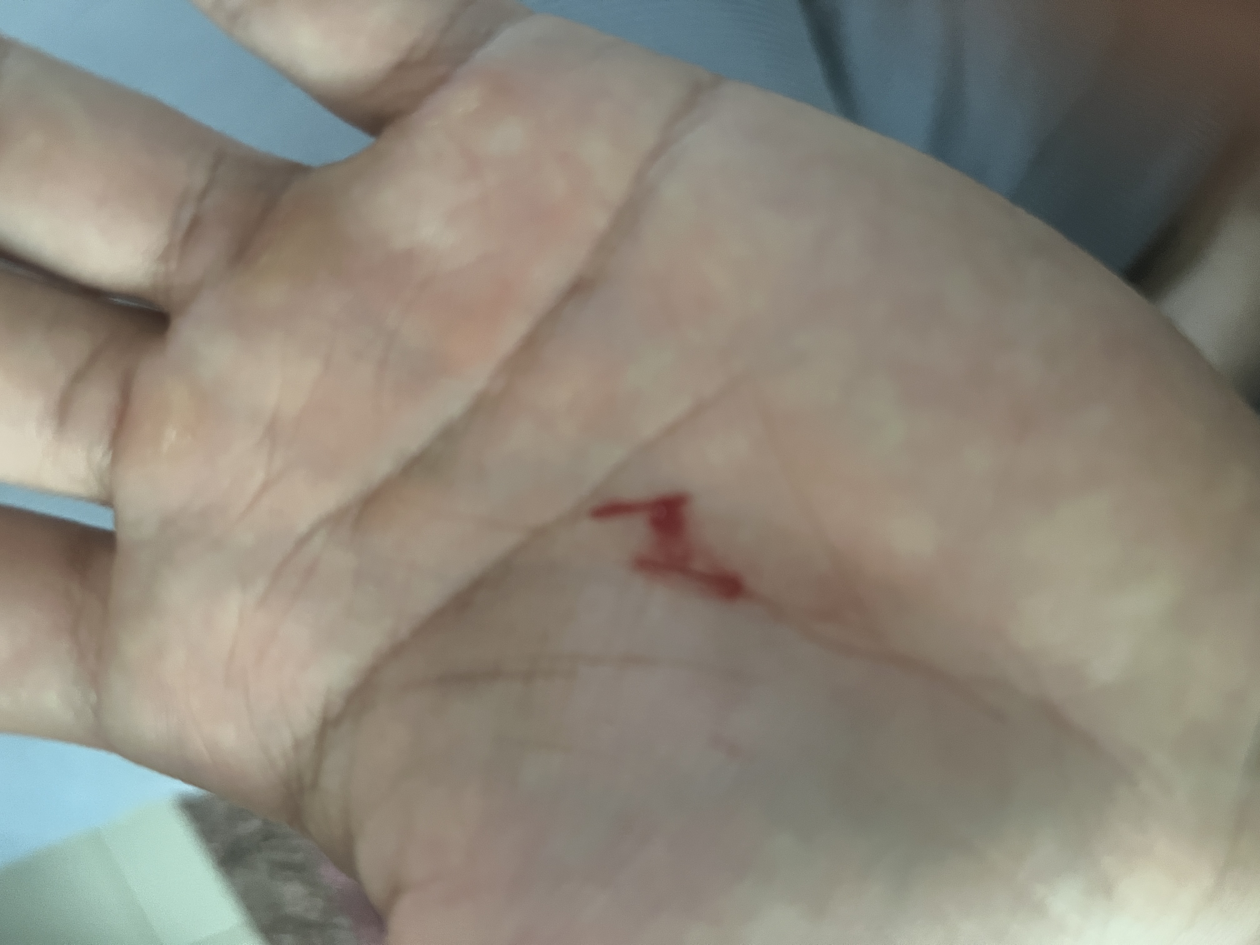 봉 뺄때 조심하세요 손바닥 베였네요